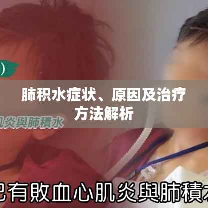 肺积水症状、原因及治疗方法解析